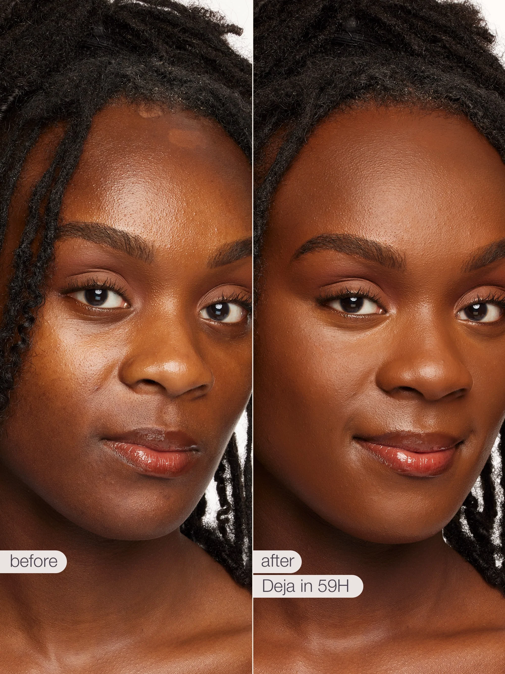 Product image 100
